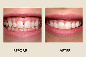 Cosmetic Dentistry - Santa Maria